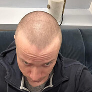 Watermelon Felon