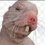 Fecal Clump