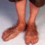 Miltons feet