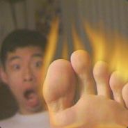 Burningfoot