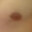 Math1L's left nipple