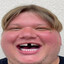 Kohute