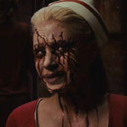 субконъюнктивальное кровоизлияни