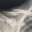 SEXY COLLARBONE