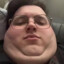 Being Fat is not Being Obese