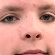 Nubbs