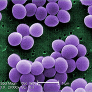 staphylococcus aureus