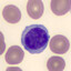Innate Lymphoid Cell