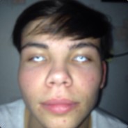 a ya takoi begu i volosi nazad