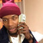 Fetty Wap&#039;s Missing Eye