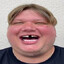 Neoni