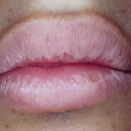 lips