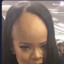 Forehead