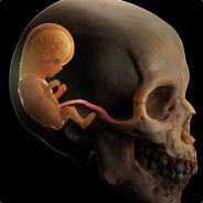 TechTonic - steam id 76561197961858251