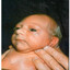 Nick's Life With Microcephaly