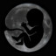 Moon Fetus
