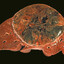 ff-Paracetamolum