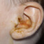 Xander&#039;s Ear Fungus