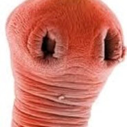 Описторхоз