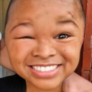 严辉村第一突破手勤始