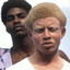 Negro Albino