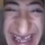 Ronakles