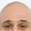 PELADO INSANO