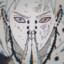 Pain