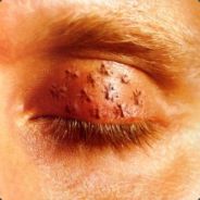 oddeye - steam id 76561197960446519