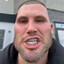 ForeSkin