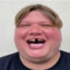 s2Bmple