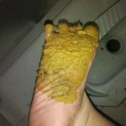 一不小心踩屎了