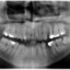 Renegade molar