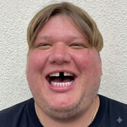 d1mple