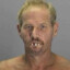 crack addict