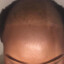 The Notorious Bald