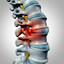 Scoliosis peek