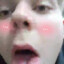 -iNs