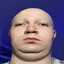 EGG WILL WIN