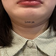 🆅🅰🆂🆂🅸🅻🆈