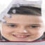 Glinees