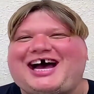 s1mple（Pto max青春版）