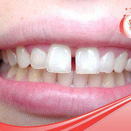 \u54c8\u7ef4j\u53eb\u7237