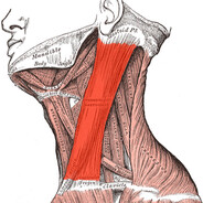 Esternocleidomastoideo