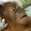 Cancer Ape