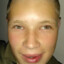 VitoOG