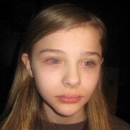 красные глаза