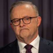 Anthony Albanese (real)