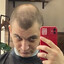 Mr. ALOPECIA