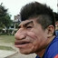 xhen